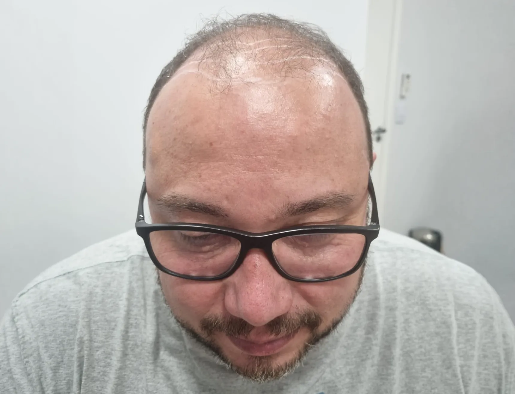 Antes